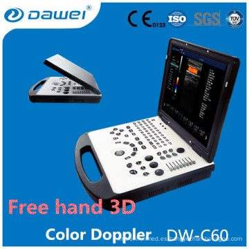Precio de la máquina del eco de DW-C60 2d, precio del ultrasonido del doppler del color de la computadora portátil
